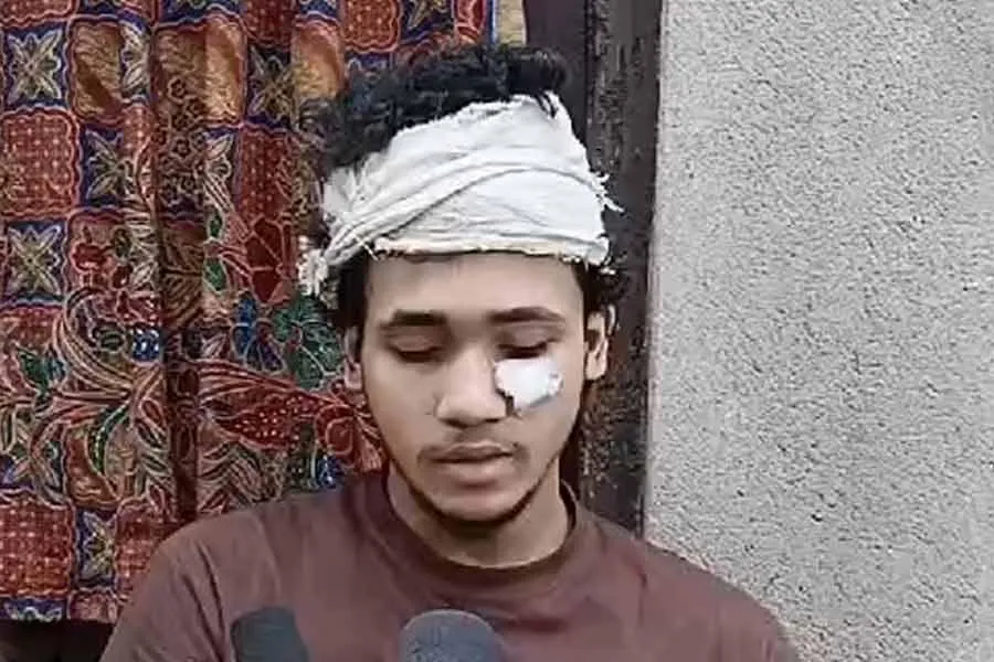 ঢাকায় বন্ধুর বাড়ি বেড়াতে গিয়ে আক্রান্ত কলকাতার যুবক