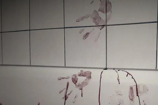 ফরিদপুরে হিন্দু সাংবাদিকের মা এবং মুক্তিযোদ্ধা বাবাকে ধারাল অস্ত্রের কোপ